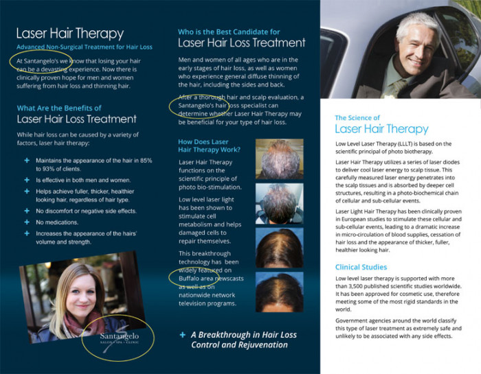 Laser Hair Therapy Brochure, Customizable - Image 2