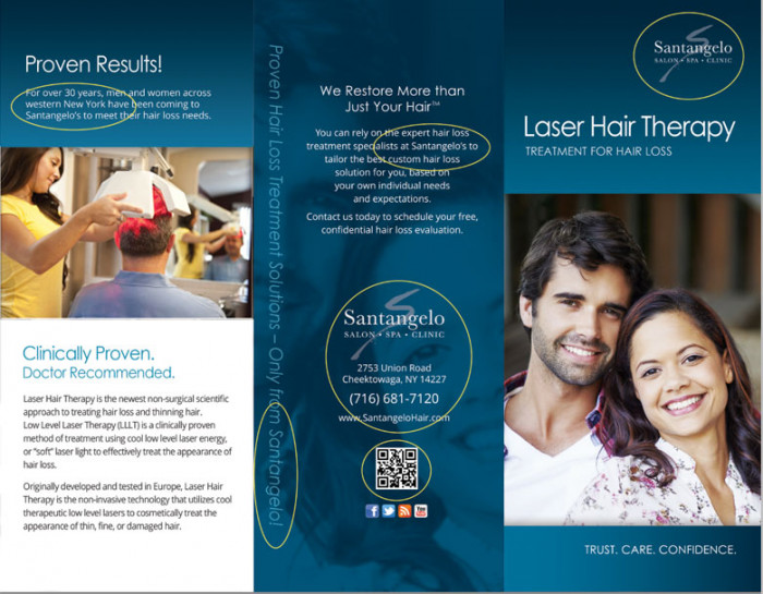 Laser Hair Therapy Brochure, Customizable